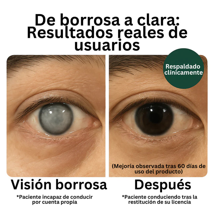 Zooone | Suplemento de Luteína para los ojos